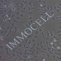 SK-OV-3-PLV-LUC-BSD人卵巢癌细胞丨荧光素酶标记