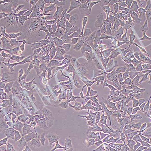 Hep3B2.1-7-LUC人肝癌细胞丨荧光素酶标记人肝癌细胞
