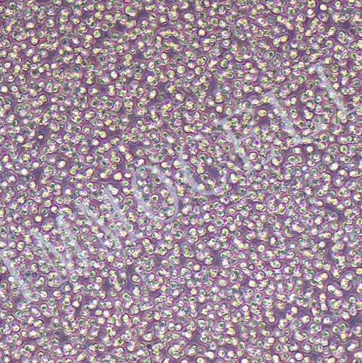 MV4-11-LUC-eGFP人急性单核细胞白血病细胞丨绿色荧光蛋白标记