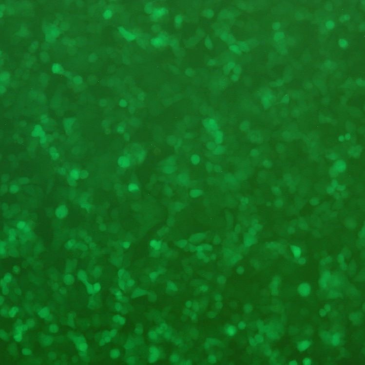 MKN-28-LUC-EGFP人胃癌细胞-荧光素酶标记-绿色荧光蛋白