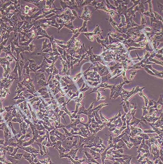 SK-N-BE(2)人神经母细胞瘤细胞丨逸漠(immocell)