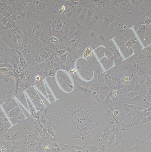 MKN7-LUC人胃癌细胞丨荧光素酶标记