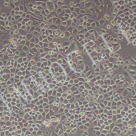 HCT-15人结肠癌细胞丨HCT-15细胞(STR鉴定)