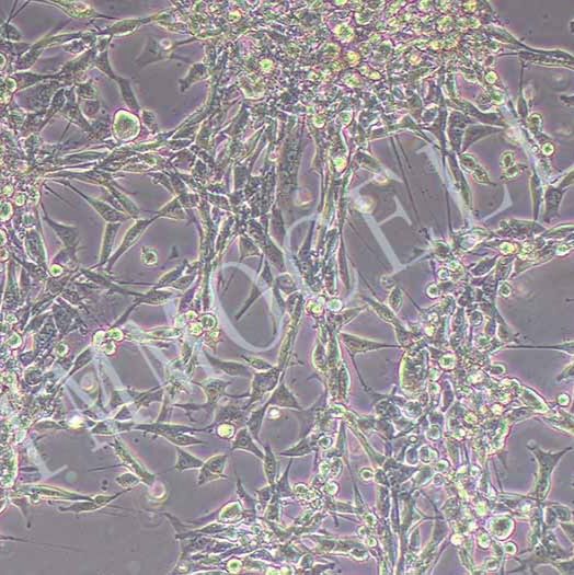 MC38-LUC小鼠结肠癌细胞丨荧光素酶标记