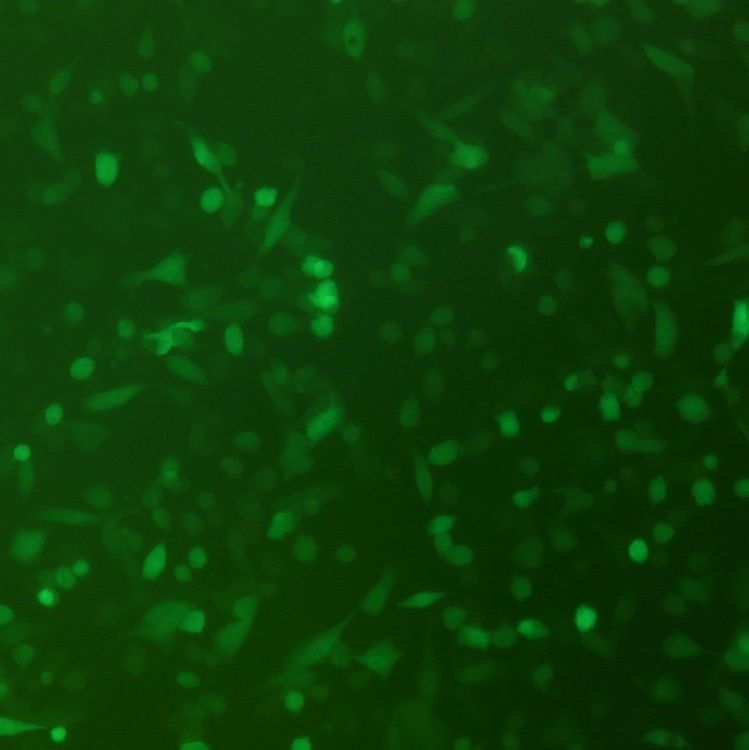 SK-HEP-1-LUC-EGFP（人肝癌细胞-荧光素酶标记-绿色荧光蛋白（STR鉴定正确））