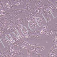 SK-MEL-2-LUC人皮肤黑色素瘤细胞丨荧光素酶标记