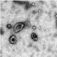 人间充质干细胞成脂诱导分化培养试剂盒