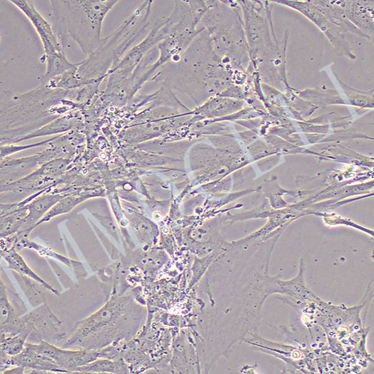 HFL-1;人肺成纤维细胞丨HFL-1人肺成纤维细胞丨逸漠(immocell)）