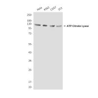 ATP Citrate Lyase (3D9) Mouse mAb