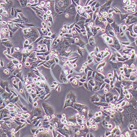 SW480-LUC人结肠腺癌细胞丨荧光素酶标记丨逸漠（immocell）
