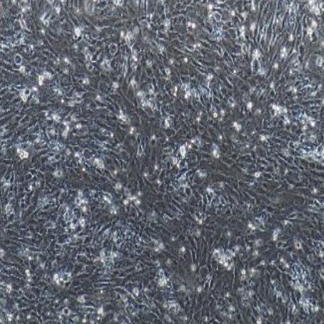 小鼠原代肾小球系膜细胞