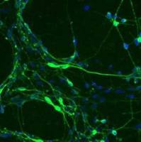 小鼠主动脉平滑肌细胞