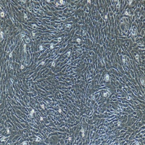 小鼠原代视网膜微血管内皮细胞