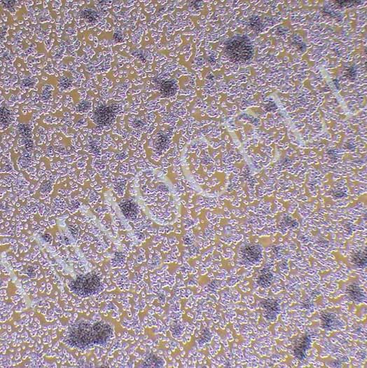 YAC-1小鼠淋巴瘤细胞丨YAC-1细胞株