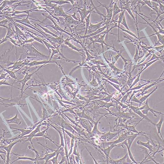OP9小鼠骨髓基质细胞丨OP9细胞