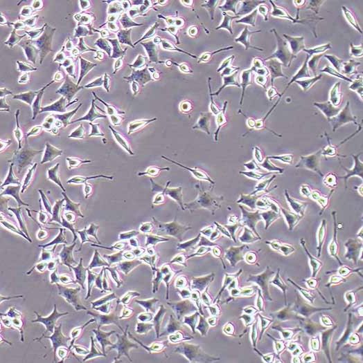 RIN-M5F大鼠β胰岛素瘤细胞