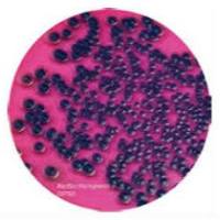 印度HiMedia 蜡样芽胞杆菌显色培养基