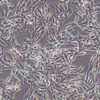 B16小鼠黑色素瘤细胞丨b16细胞价格
