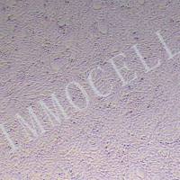 小鼠逆转录病毒包装株；PT-67丨PT-67细胞