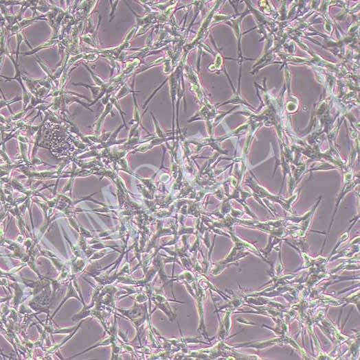 MIN6小鼠胰岛β细胞丨MIN6细胞株