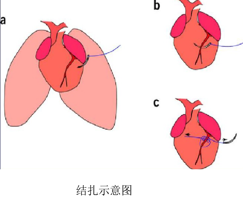 心脑血管疾病经典模型，这篇文章讲清楚了！