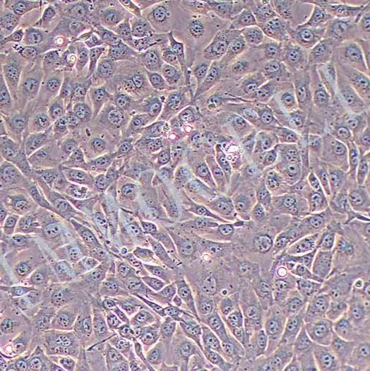 NIH/3T3小鼠胚胎细胞丨NIH/3T3细胞株