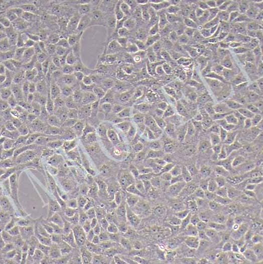 VERO C1008 E6非洲绿猴肾细胞 培养|VERO C1008 (E6)细胞 |逸漠