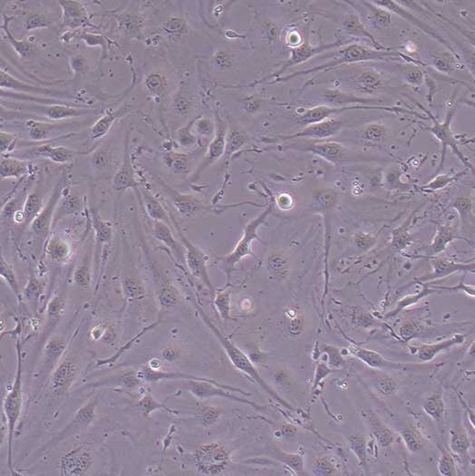 G422小鼠神经胶质瘤细胞丨G422细胞株