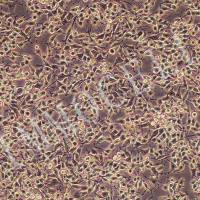 MADB106大鼠乳腺癌细胞丨MADB106细胞丨逸漠(immocell)