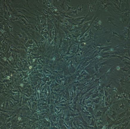 小鼠原代肝星状细胞