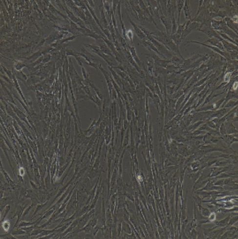 大鼠原代肝星状细胞