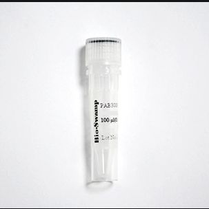 INSR Polyclonal Antibody