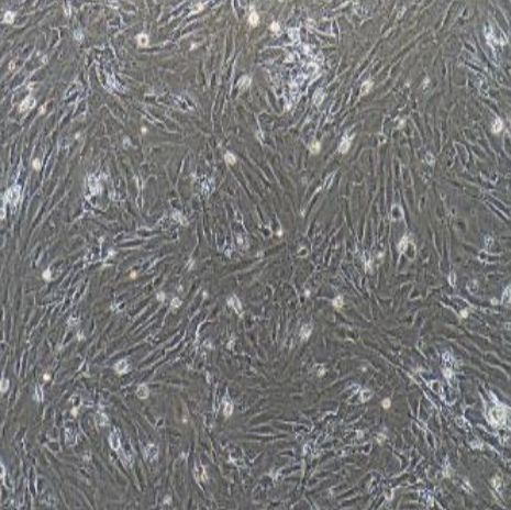 小鼠原代颈动脉成纤维细胞