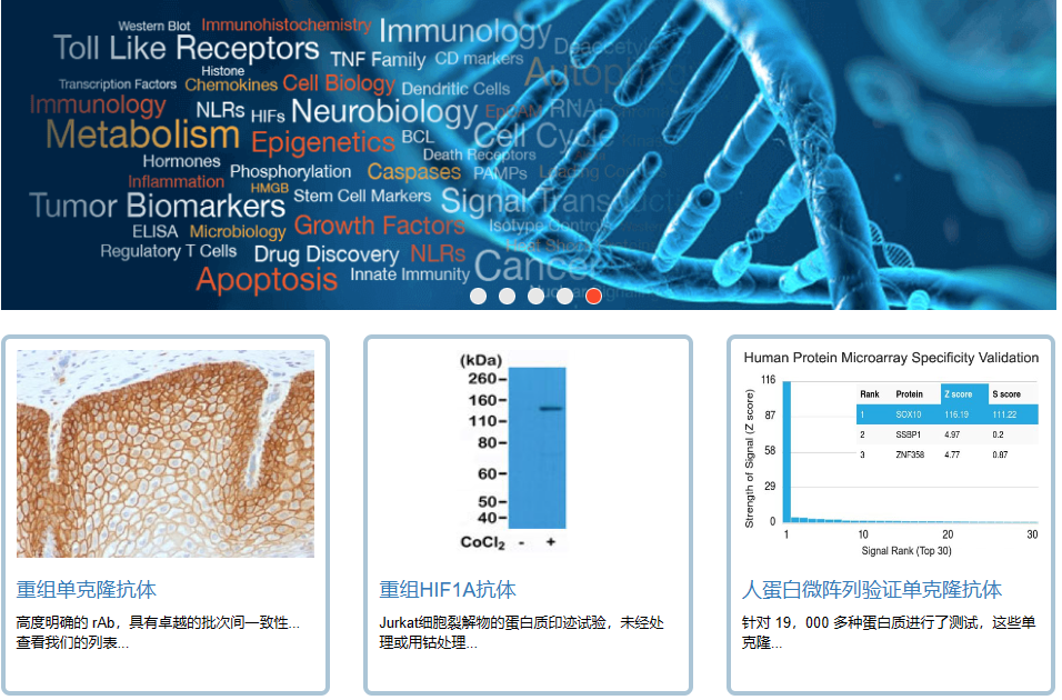 安诺伦生物授权代理NSJBioreagents品牌产品——单克隆抗体