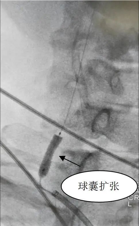 「我是家里的顶梁柱，可不能倒下！」55 岁的老张突然头晕、乏力……