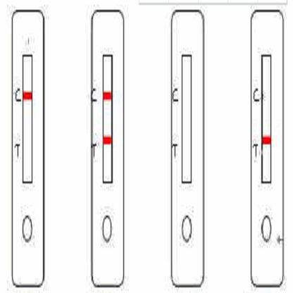 疟疾PF/PV抗原快速检测卡(胶体金法)