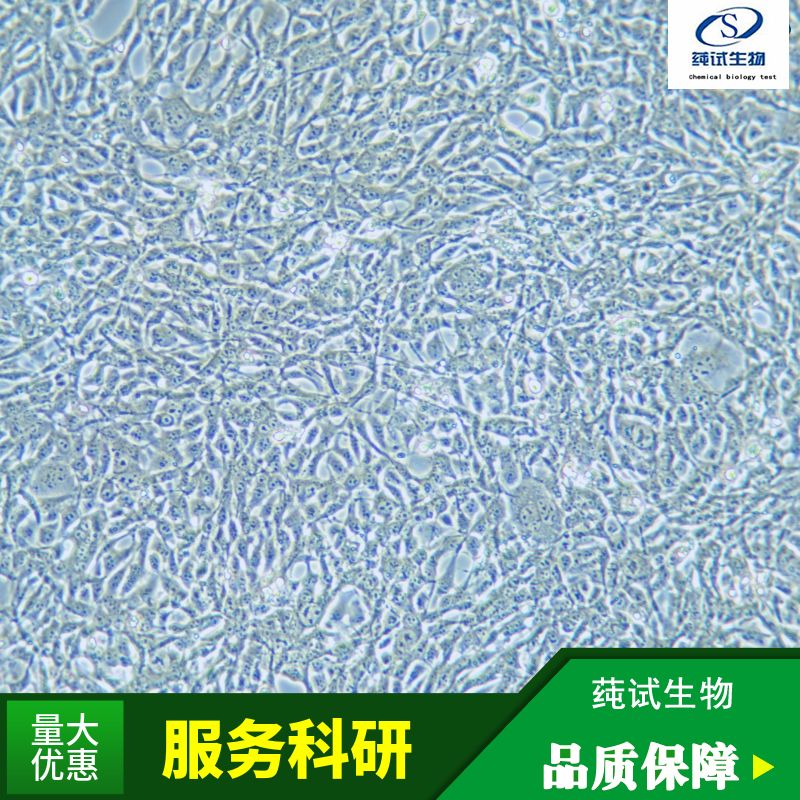HuH-6(人肝母细胞瘤细胞)