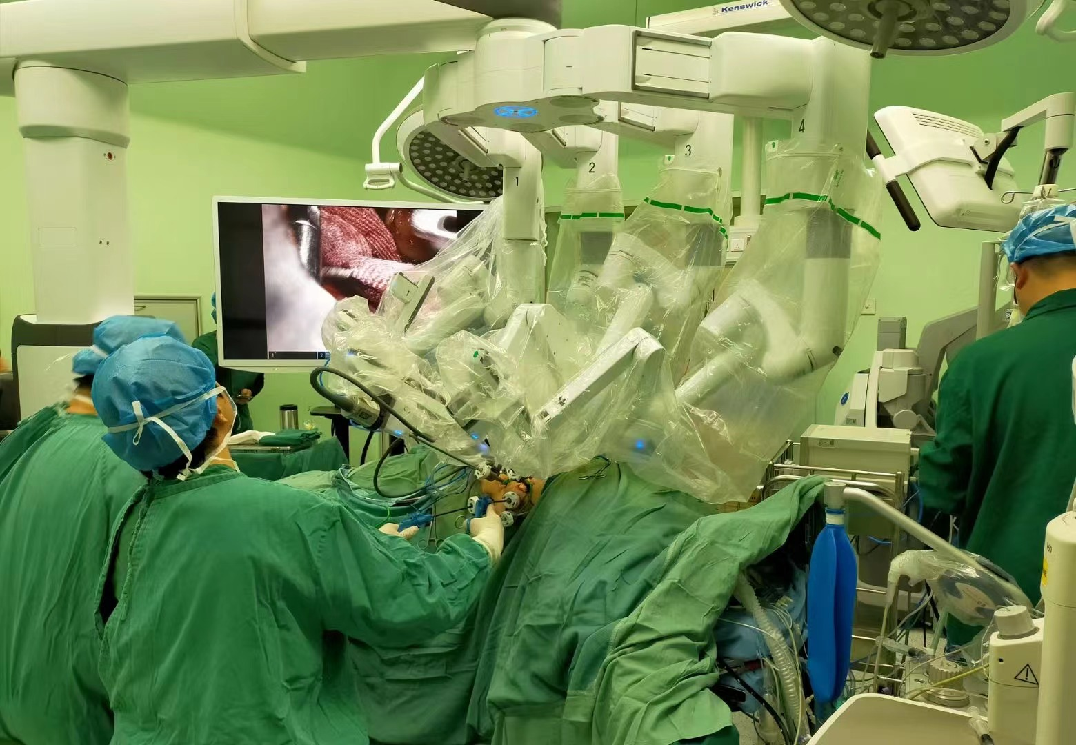 广西壮族自治区南溪山医院运用机器人勇摘泌尿外科手术「皇冠上的明珠」