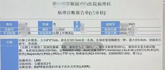 哪怕 0.1% 意外,伤害都是 100%
