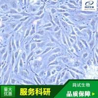 NCTC clone 929 [L cell, L-929](小鼠成纤维细胞)