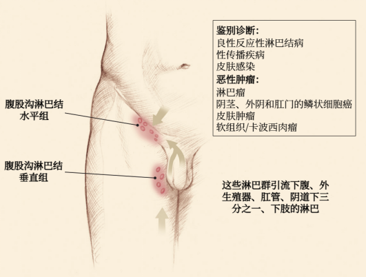 图片预览