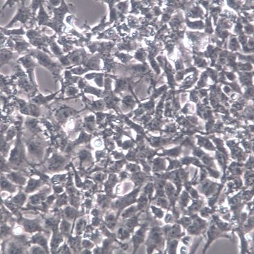 PA-1、PA-1细胞系、PA-1细胞株、PA-1人卵巢畸胎瘤细胞[STR]