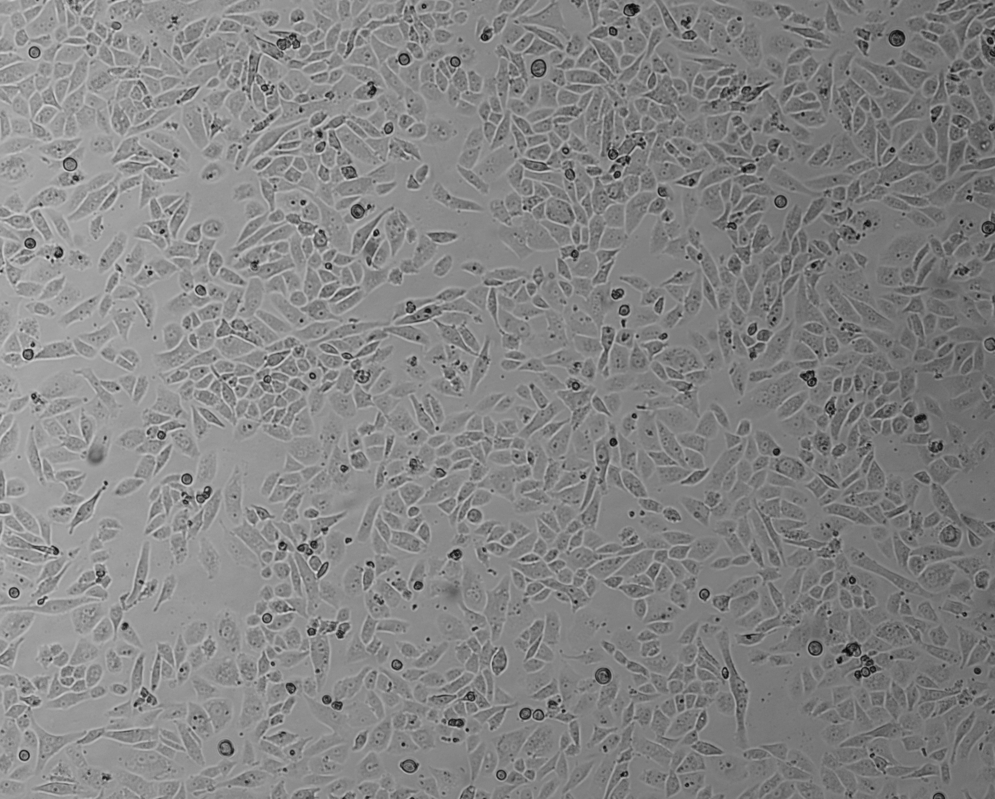 细胞攻略 | SK-LU-1(人低分化肺腺癌细胞)细胞培养教程