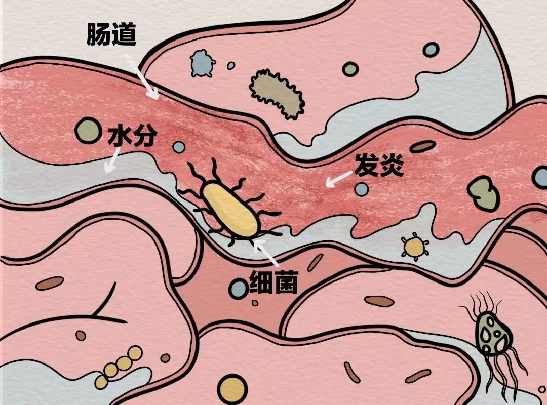 中招诺如,又拉又吐?除了抢「止泻神药」还可这样应急