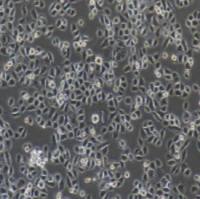 AsPC-1人转移胰腺腺癌细胞(提供STR鉴定报告)