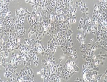 CAL-27人舌鳞癌细胞(提供STR鉴定报告)