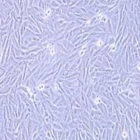 A2058人黑色素瘤细胞(提供STR鉴定报告)