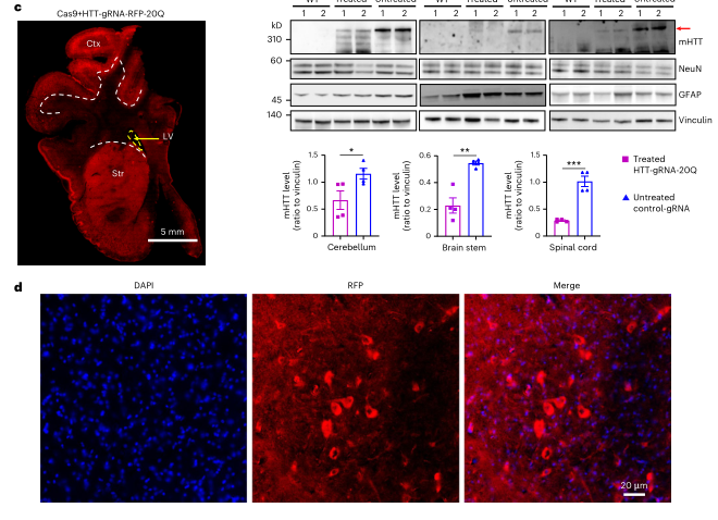 Nature子刊| 暨南大学李晓江教授团队在基因治疗神经退行性疾病大型动物模型方面取得新突破