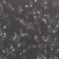 Bel-7405人肝癌细胞(提供STR鉴定报告)