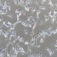 BCPAP人甲状腺癌细胞(提供STR鉴定报告)